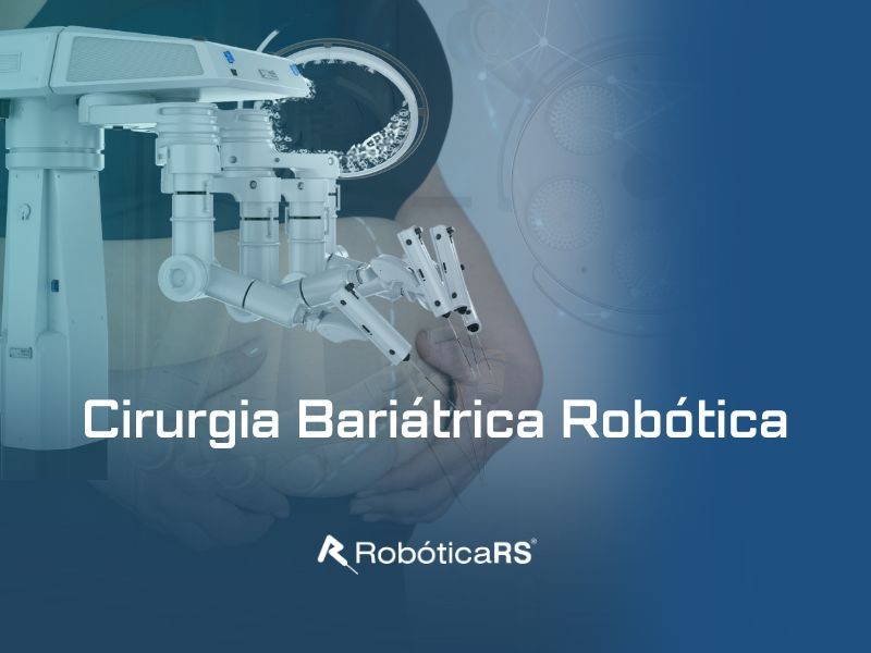 Cirurgia Bariátrica Robótica: tecnologia a serviço da precisão e da segurança do paciente